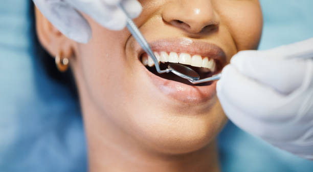 Best Emergency Cosmetic Dentistry (e.g., broken veneers) in Fountain, CO