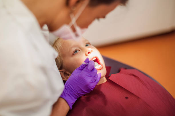 Best Emergency Wisdom Tooth Extraction in Fountain, CO